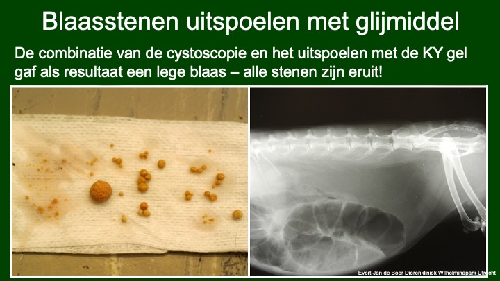 Cystoscopisch blaasstenen verwijderen.